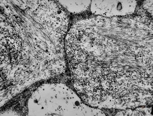 M, 1y. | gangliosidosis - liver M, 1y. | gangliosidosis - liver
